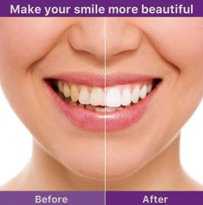 HiSmile V34 Teeth Whitening Purple Toothpaste